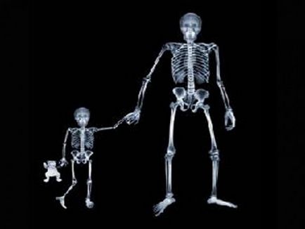 X-ray sau Mantoux pentru copii este la fel de periculoasă - știri rusești