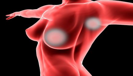 Rezultatele mamografiilor glandelor mamare