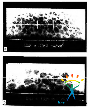 Cornea - # 9474; partea 1