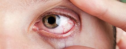 Cornea - a szerkezet és a funkció (szerkezete) Cornea - a szerkezet és a funkció