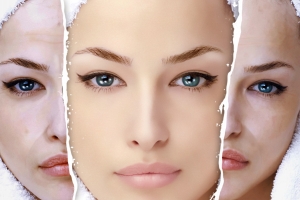Szépségszalonok, hogyan kell rögzíteni az orrod nélkül orrplasztika