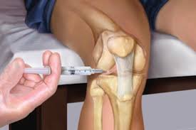Cartilajul deformat în articulația genunchiului, tratament, ce trebuie făcut