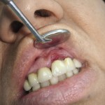 fogászati ​​magazin 1 Dental Journal