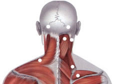 Tratamentul gâtului și tratamentul sindromului cervical-cranial