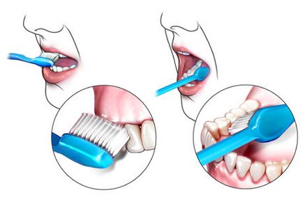 Îngrijirea orală după implantare dentară, centrul de stomatologie 
