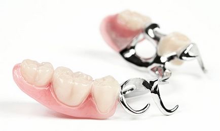 Proteticele plate (inserați dinții)