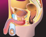 Varicocelul din dreapta provoacă dezvoltarea, simptomele, diagnosticul și tratamentul