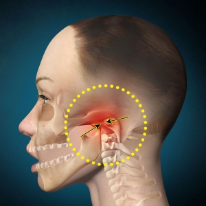 Dislocarea articulației maxilarului, ceea ce este periculos este o traumă în articulația maxilarului