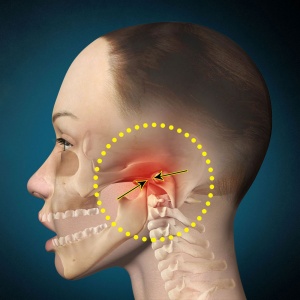 Вивих щелепного суглоба, чим небезпечна травма в суглобі щелепи
