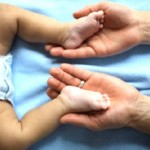 Veleszületett csípőficam csípő csecsemők Photo
