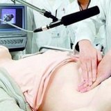 Chirurgie peritonită, sepsis abdominal - bisturiu - informații medicale-educative