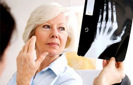 Ce este artrita reumatoidă tratată cu metode moderne noi, recomandări clinice