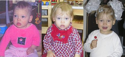 Діти до і після усиновлення (фото)