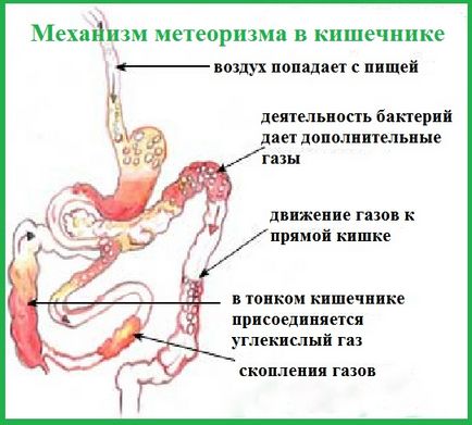 Дієта при метеоризмі і здутті у дорослих - що їсти