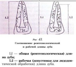 Ендодонтско лечение на зъби