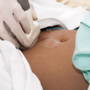 Fibroidul ovarian cauzează, simptome, diagnostic și tratament
