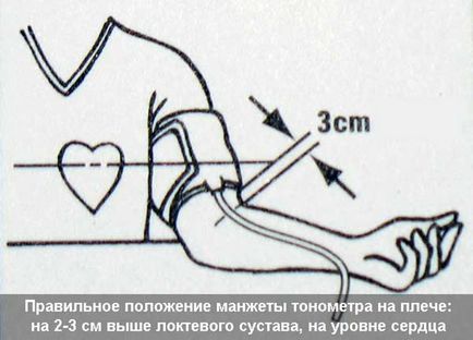 Як виміряти тиск механічним тонометром і як зробити це правильно