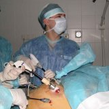 Cum funcționează operația laparoscopică - bisturiu - informație medicală-educativă