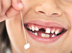 Cum dintii copiilor sunt scosi de la copii