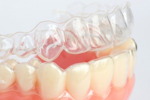 Капа для зубів особливості і застосування - можливо кращий сайт про лікування зубів