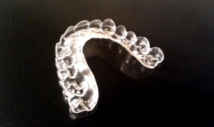 Capa fogászati ​​jellemzői és alkalmazása - lehet a legjobb hely a fogászatban