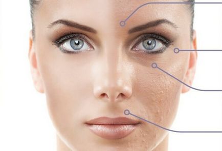 A mechanikai tisztítás az arc - jelzi ügyességi cosmetologist