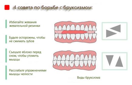 Нічне скреготіння зубами - причини, засоби лікування та наслідки бруксизма у дітей і дорослих