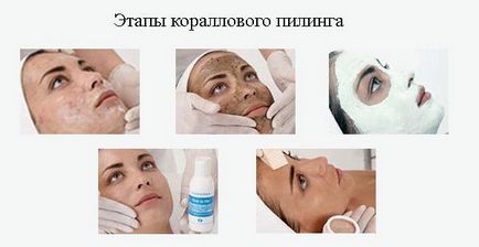 Peeling rosacea tehetünk a bőr (hámlás rosacea) Peeling rosacea tehetünk a bőrt