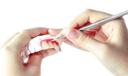Műanyag gumi - gingivoplasty, implantáció során, illetve azt követően az ár Moszkva, típusai és jellemzői,