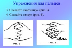 Після перелому не згинається палець як розробити