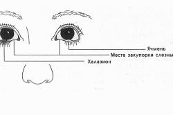 Причини появи ячменю на оці класифікація, лікування