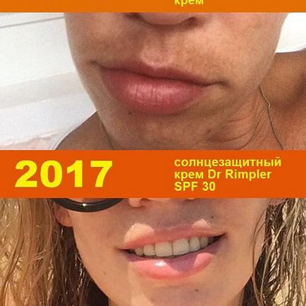 Professzionális kozmetikai @ortmann_beauty Instagram profil picbear