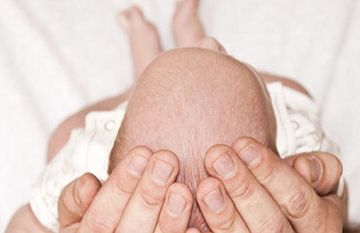 Seborrhea a fejbőr gyermekeknél okoz, tünetei és kezelése fejbőr
