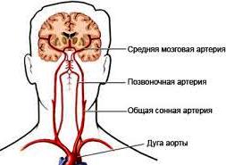 Sleepy arteries - boli ale arterelor carotide