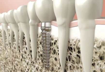 Стоматологія в приморському районі спб, гільдія стоматологів, якісно і недорого
