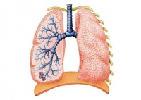 Transplantul pulmonar la copii este deja o realitate atunci când se tratează în străinătate