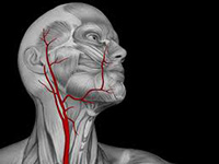 Boli ale arterelor carotide