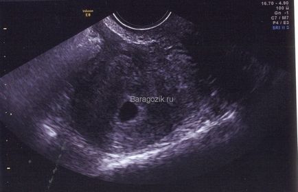 2 săptămâni de senzație de sarcină a unei femei înainte de concepție și ovulație - calendarul cel mai detaliat