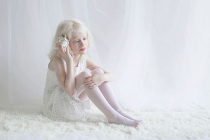 33 Fotografii și 18 fapte despre albinos - cercetașul