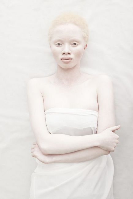 33 Fotografii și 18 fapte despre albinos - cercetașul