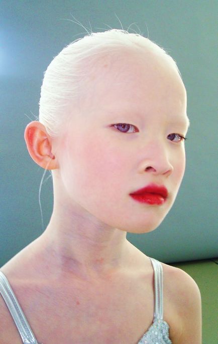 33 Fotografii și 18 fapte despre albinos - cercetașul