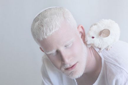 33 Фото та 18 фактів про альбіноса - зожнік