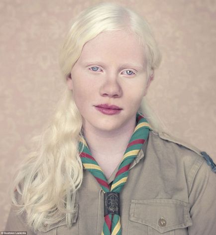 33 Fotografii și 18 fapte despre albinos - cercetașul