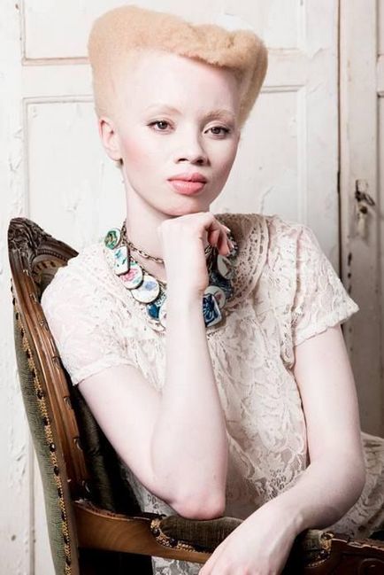 33 Fotografii și 18 fapte despre albinos - cercetașul