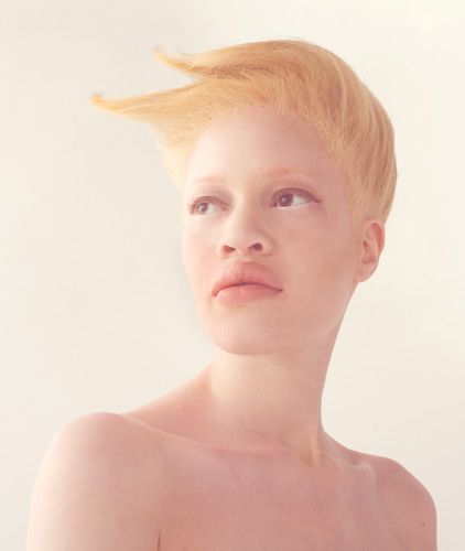 33 Fotografii și 18 fapte despre albinos - cercetașul