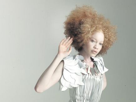 33 Fotografii și 18 fapte despre albinos - cercetașul