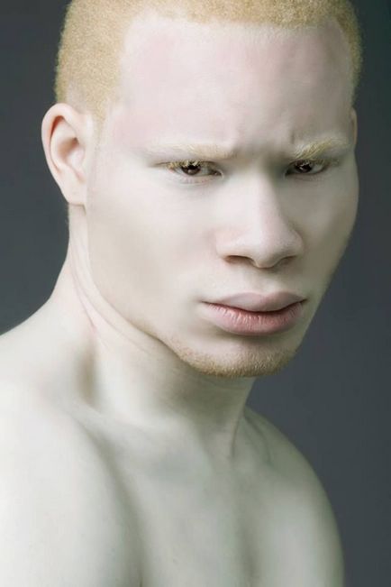 33 Fotografii și 18 fapte despre albinos - cercetașul