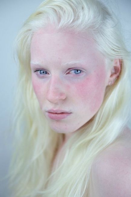 33 Fotografii și 18 fapte despre albinos - cercetașul