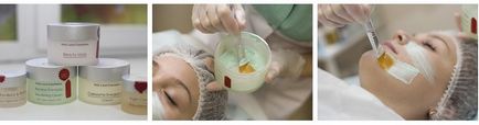 ABR peeling leírás, ár és értékelés (ABR peeling vélemény) ABR peeling leírás árak és vélemények