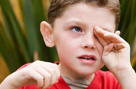 Алергія навколо очей на шкірі причини і методи лікування
